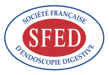 SFED